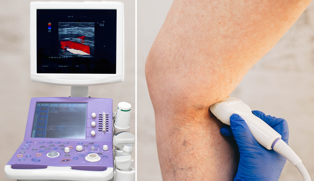 Photo of an imaging machine on the left and a leg with ultrasound wand placed behind the knee by a technician