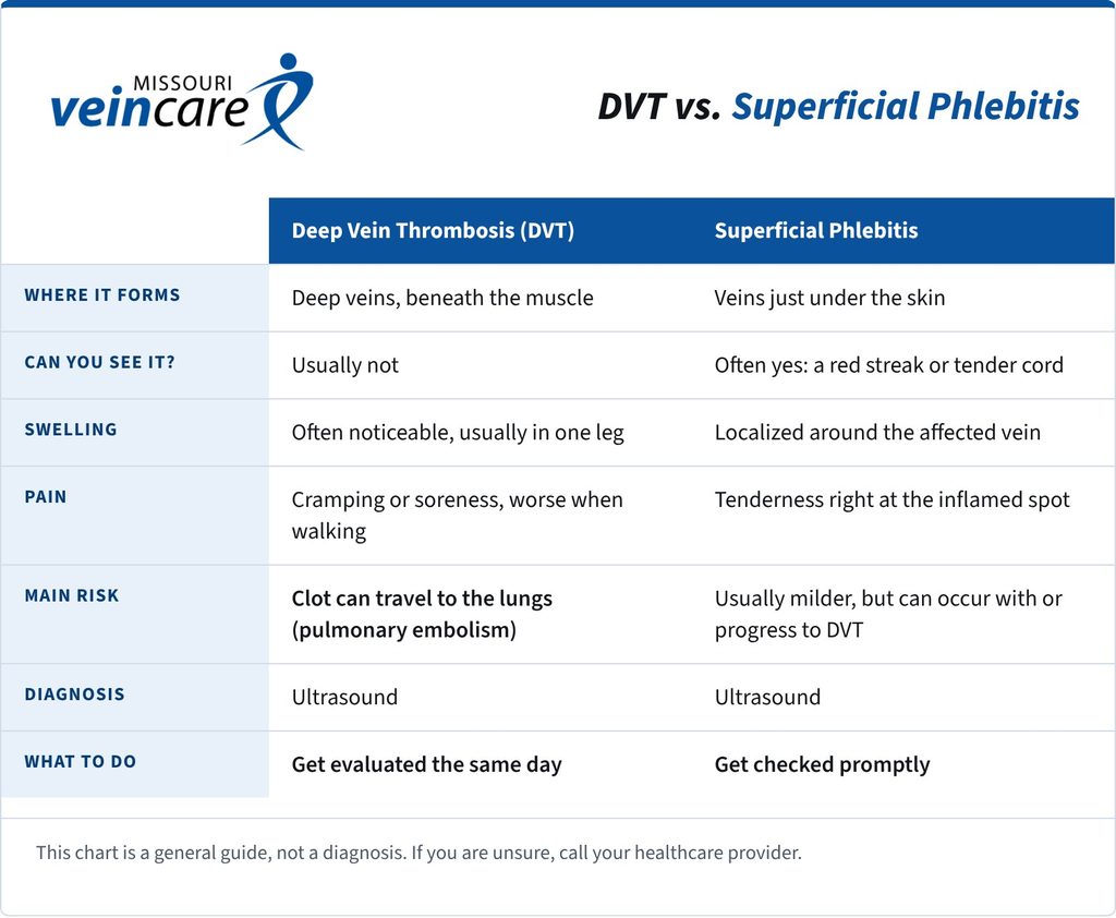 mvc dvt vs superficial phlebitis chart